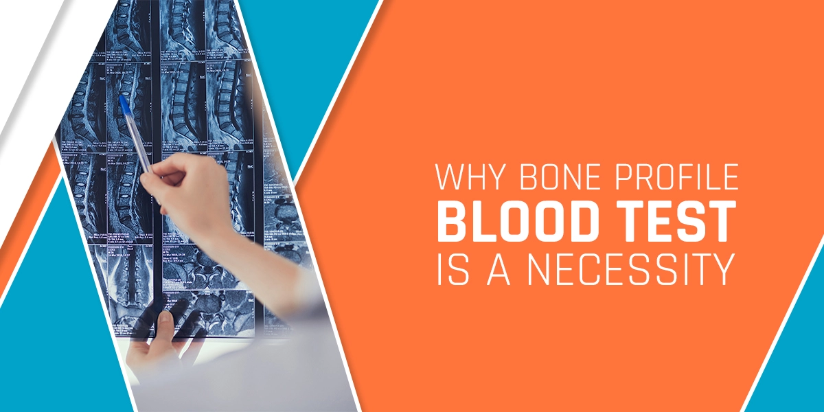 Why Bone Profile Blood Test Is A Necessity?